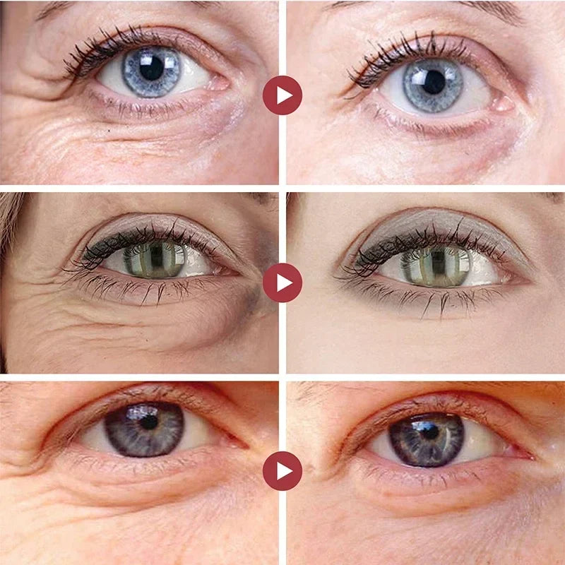 Firming Anti-Wrinkle Remove Eye Bags